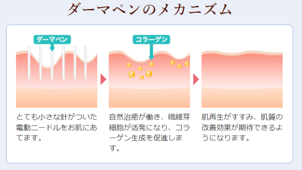 ダーマペンのメカニズム